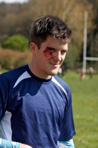 injury